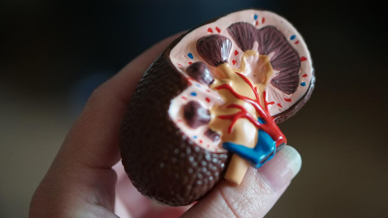 a model of a kidney